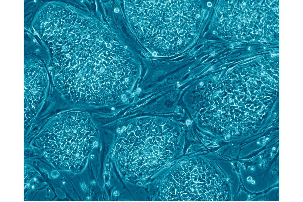 Embryonic Stem Cells. Image shows hESCs.